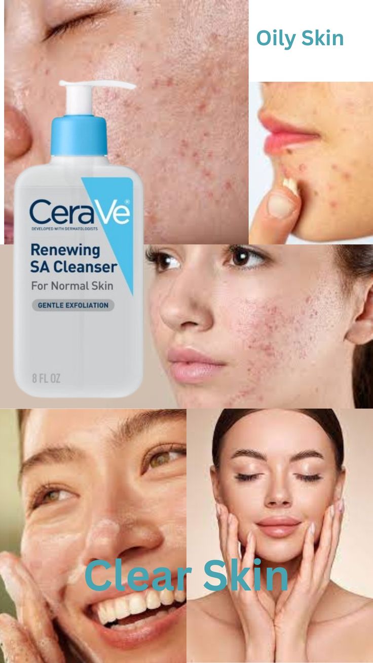 CeraVe - Renewing SA Cleanser - 237ml